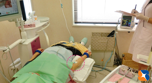 静脈麻酔鎮静法で恐さを消失リラックス作用