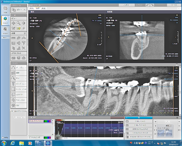 親知らずティース teethナビゲーション