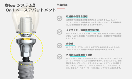最先端インプラント部品／On1アバットメント