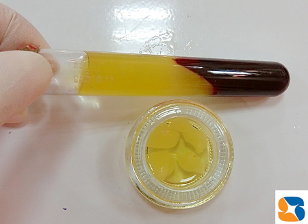 添加物なしの自己血液由来のCGF