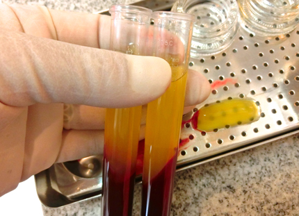 横向き　親知らず　難しい抜歯　テルプラグ代用