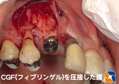 特定細胞加工施設