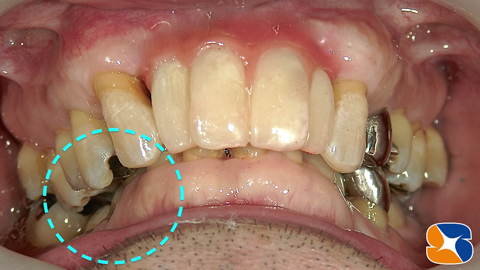 奈良　生駒　大阪　インプラント　点滴　再生療法　悩み相談