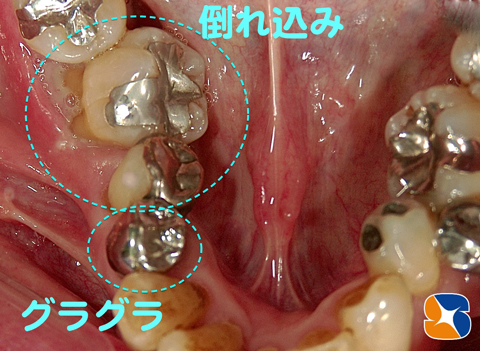 奈良　生駒　大阪　インプラント　静脈麻酔点滴　再生療法　悩み相談
