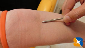 静脈麻酔鎮静法　インプラント　無料