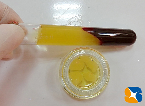 横向きの親知らず　静脈麻酔鎮静　保険　大阪　奈良