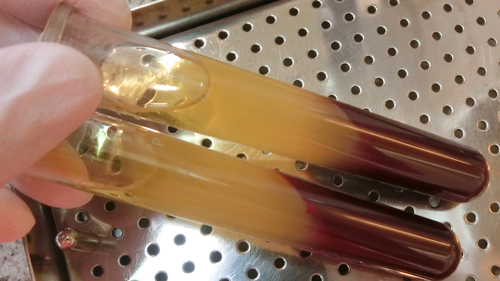 フィブリ　CGF  近畿厚生局認可施設　