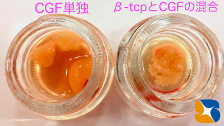 自己血液を採取して無添加でコラーゲンゲルを製作