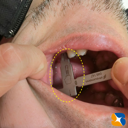 入念に手術前の検査を実地