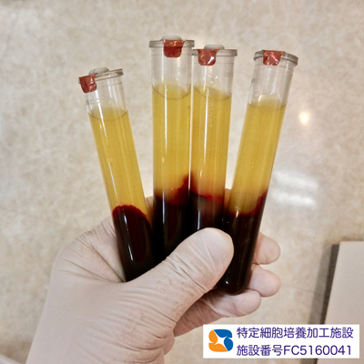 安心　安全　無添加の自己血液由来　フィブリノーゲン