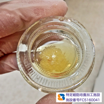 安心　安全　無添加の自己血液由来　フィブリノーゲン