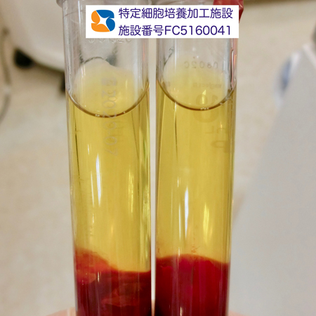 点滴　採血　フィブリノーゲン