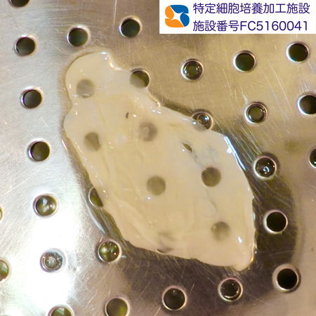 フィブリノーゲン　メンブレン膜