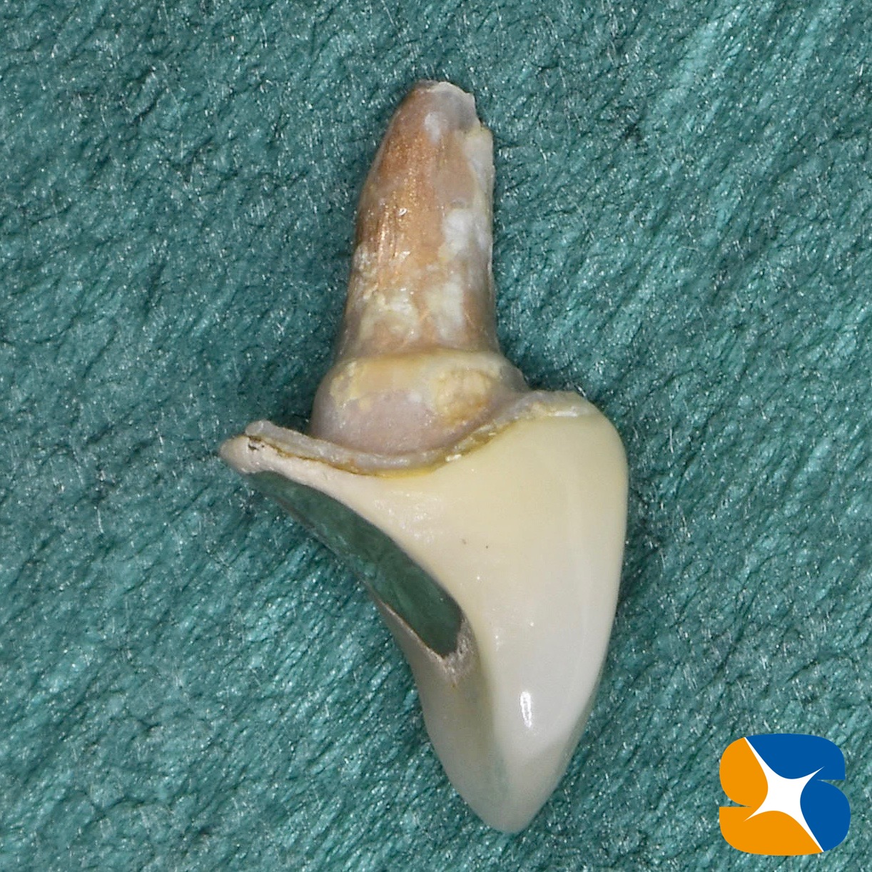 奈良　大阪　インプラント　安全　確実　点滴　良心的　経験豊富