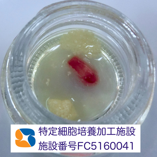 奈良　生駒　石切　大阪　痛くない怖くない再生医療インプラント