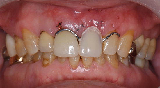 再生治療　静脈麻酔鎮静　無料　サービス　良心価格　１０年保証