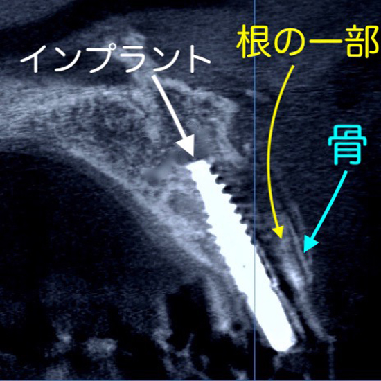 再生治療　静脈麻酔鎮静　無料　サービス　良心価格　１０年保証