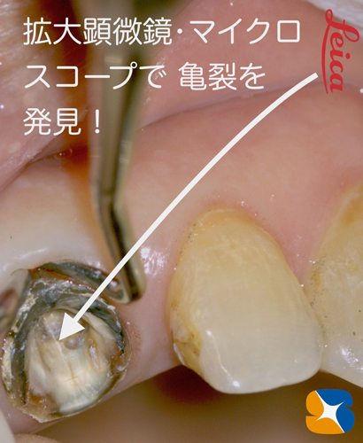 インプラント　奈良　生駒　大阪　静脈麻酔鎮静　無料　最新治療　再生医療