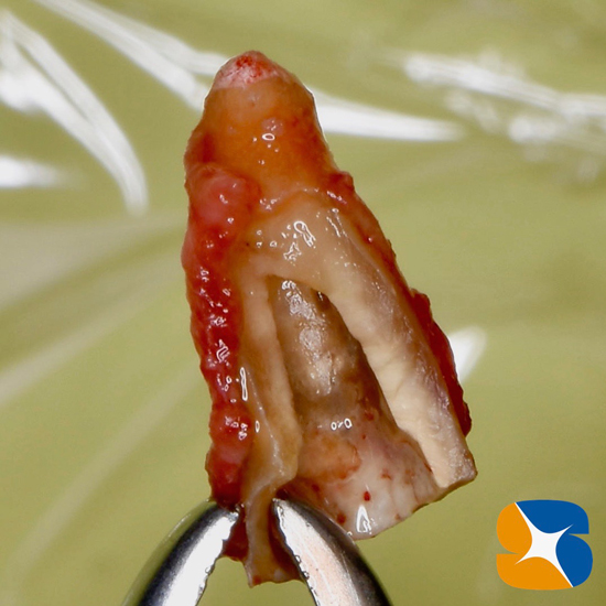 奈良　大阪　インプラント　安全　確実　点滴　良心的　経験豊富