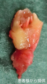 学園前　生駒　西大寺　石切　再生治療歯科　無料の静脈麻酔鎮静法