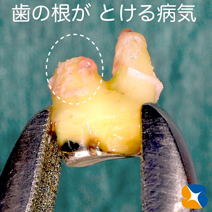 石切　生駒　奈良　大阪　インプラント　近畿厚生局認可　再生医療施設　静脈麻酔鎮静法