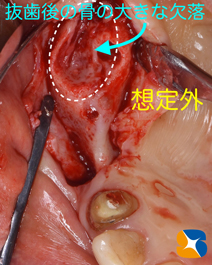 石切　生駒　奈良　大阪　インプラント　近畿厚生局認可　再生医療施設　静脈麻酔鎮静法