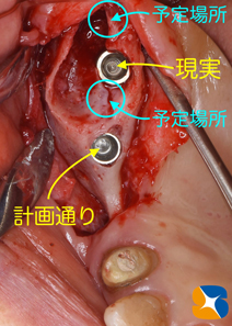 石切　生駒　奈良　大阪　インプラント　近畿厚生局認可　再生医療施設　静脈麻酔鎮静法