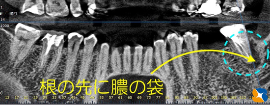奈良　生駒　最新再生医療インプラント　石切　大阪　静脈麻酔鎮静無料