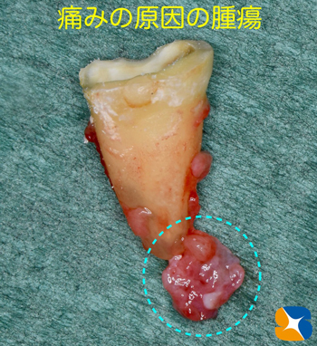 奈良　生駒　最新再生医療インプラント　石切　大阪　静脈麻酔鎮静無料