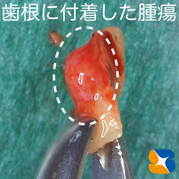 奈良　生駒　最新再生医療インプラント　石切　大阪　静脈麻酔鎮静無料