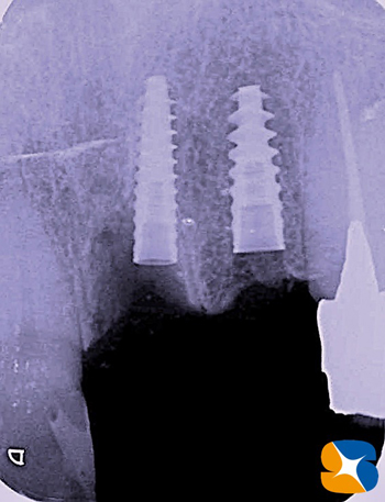 東大阪　奈良　生駒　歯医者　寝ながら怖くない　保険で安心料金　点滴鎮静法適用