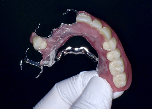 奈良市　生駒市　大和郡山市　東大阪市　インプラント　先進医療の再生医療　骨の再生　怖くない点滴麻酔　静脈麻酔鎮静　手術は１回　短期間