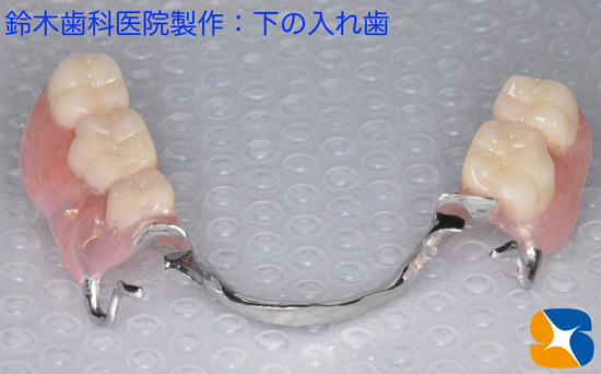 大阪　石切　保険　目立たない保険の入れ歯　装着感良い　優れた入れ歯　奈良