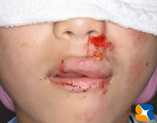 鈴木歯科医院　大阪　奈良　石切　再生医療　