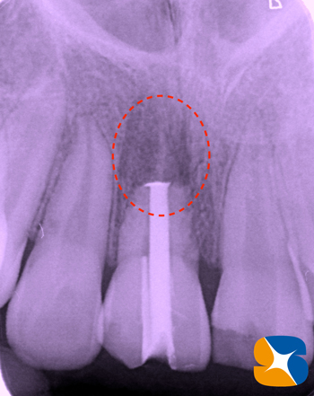 鈴木歯科医院　大阪　奈良　石切　再生医療　