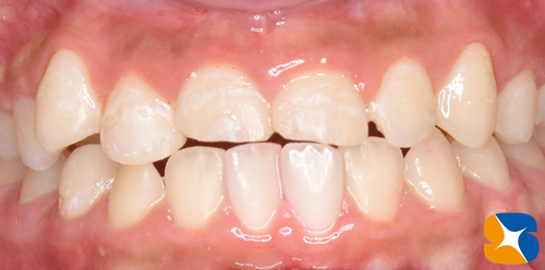 鈴木歯科医院　大阪　奈良　石切　再生医療　