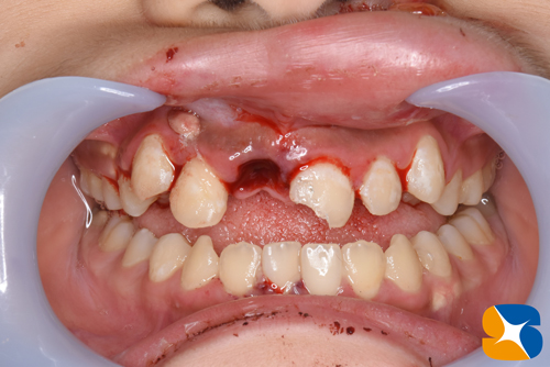 鈴木歯科医院　大阪　奈良　石切　再生医療　