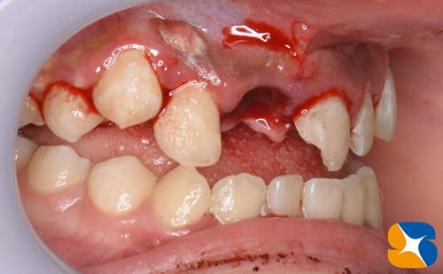 鈴木歯科医院　大阪　奈良　石切　再生医療　