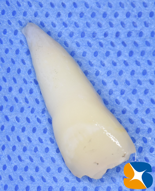 鈴木歯科医院　大阪　奈良　石切　再生医療　