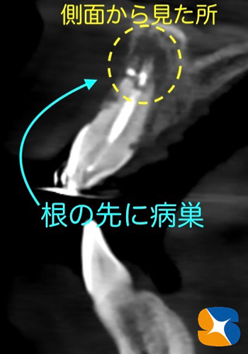 鈴木歯科医院　大阪　奈良　石切　再生医療　