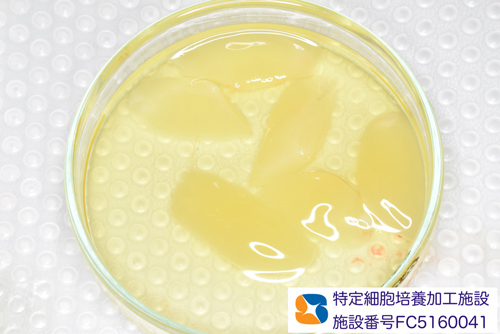 石切駅前　鈴木歯科医院　静脈麻酔鎮静保険抜歯　再生医療コラーゲンゲル　手に汗握る抜歯を寝ながら施術　コラム実例多数　最新CTで要チェック