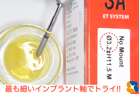 東大阪　奈良　石切駅前　鈴木歯科　ブルーラジカル　静脈麻酔鎮静　寝ながらリラックス　歯周病　インプラント　失った骨の再生医療　血液コラーゲン　歯科用最新CT精度が高い　正確な診査と診断