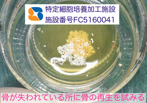 東大阪　奈良　石切駅前　鈴木歯科　ブルーラジカル　静脈麻酔鎮静　寝ながらリラックス　歯周病　インプラント　失った骨の再生医療　血液コラーゲン　歯科用最新CT精度が高い　正確な診査と診断