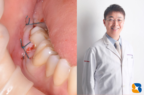 東大阪　奈良　石切駅前　鈴木歯科　ブルーラジカル　静脈麻酔鎮静　寝ながらリラックス　歯周病　インプラント　失った骨の再生医療　血液コラーゲン　歯科用最新CT精度が高い　正確な診査と診断