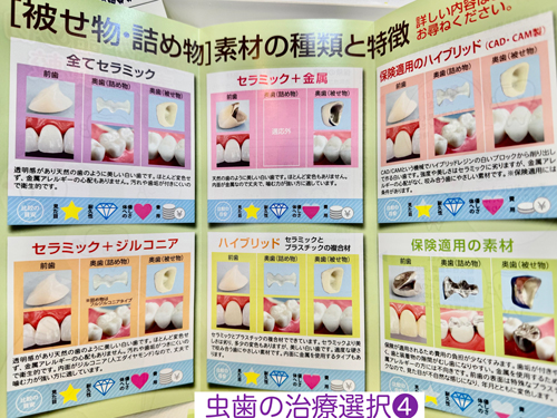 奈良・東大阪石切の鈴木歯科医院　親知らず難抜歯　保険で静脈麻酔治療専門　歯医者　怖い　寝ながら睡眠治療　ブルーラジカル専門