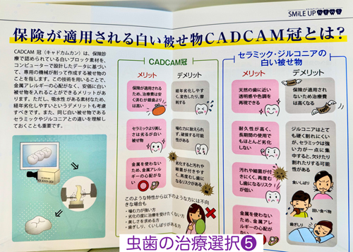 奈良・東大阪石切の鈴木歯科医院　親知らず難抜歯　保険で静脈麻酔治療専門　歯医者　怖い　寝ながら睡眠治療　ブルーラジカル専門