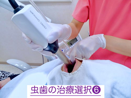 奈良・東大阪石切の鈴木歯科医院　親知らず難抜歯　保険で静脈麻酔治療専門　歯医者　怖い　寝ながら睡眠治療　ブルーラジカル専門