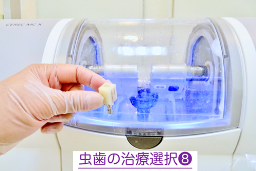 奈良・東大阪石切の鈴木歯科医院　親知らず難抜歯　保険で静脈麻酔治療専門　歯医者　怖い　寝ながら睡眠治療　ブルーラジカル専門