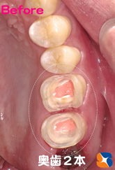 出国３日前の状態