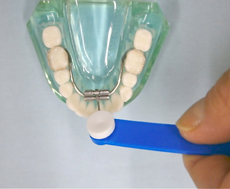 下あごの拡大装置の回し方